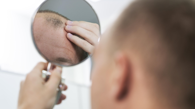 Combat Hair Loss for Long-Term Results with Customized Medical and Regenerative Treatments